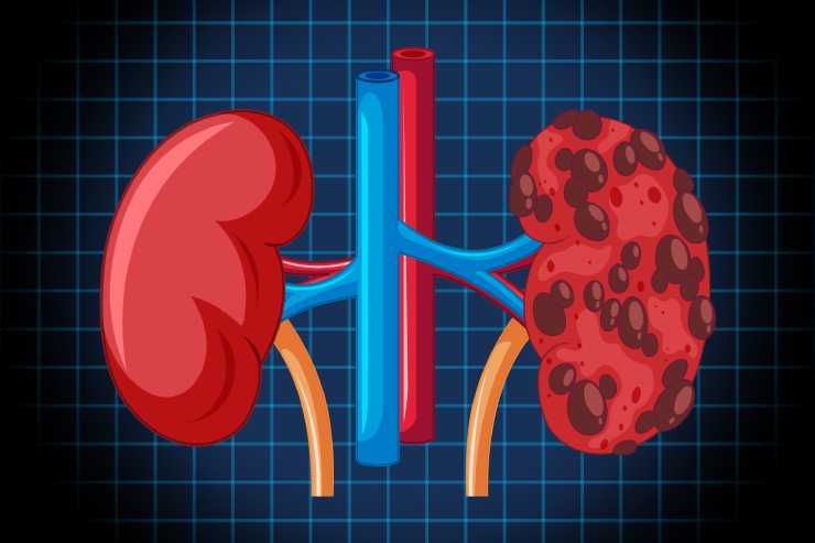 Adrenal disorders